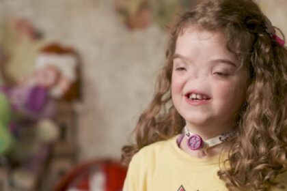 meisje wordt zonder neus geboren tien jaar later is ze een inspiratie voor velen