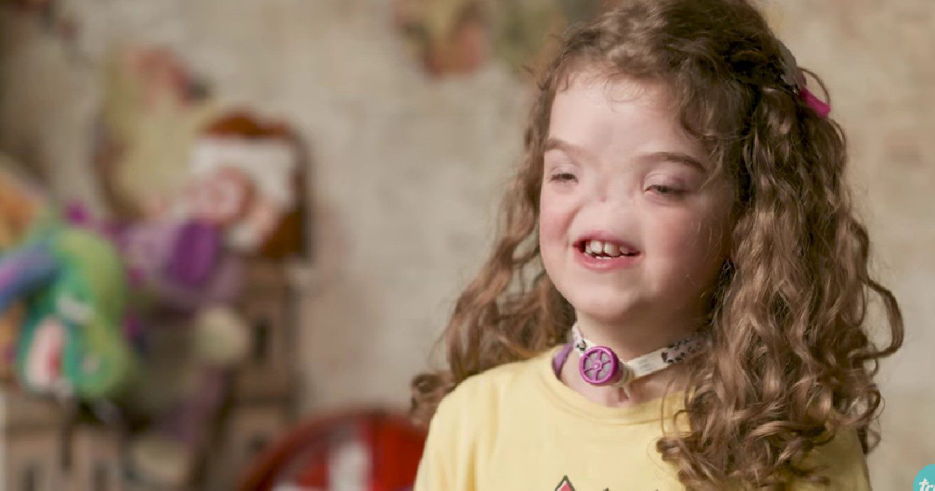 meisje wordt zonder neus geboren tien jaar later is ze een inspiratie voor velen