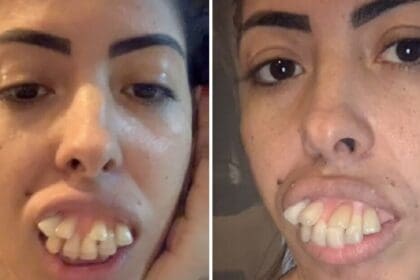 Jaquelines gebit gaat viraal, maar miljoenen twijfelen aan de echtheid van haar transformatie