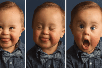 Kledingbedrijf weigert om een jongen met Down syndroom te gebruiken - het antwoord van de moeder wordt gevierd door duizenden