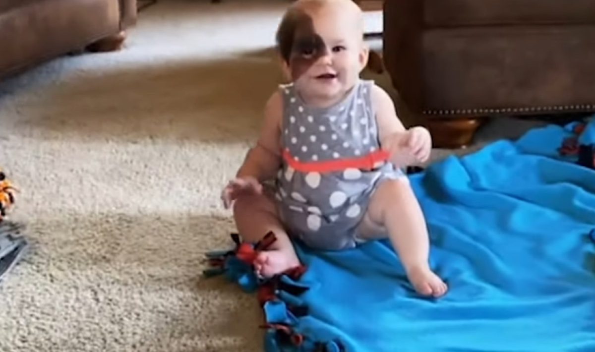 moeder hoopt te laten zien dat verschillen mooi zijn door zeldzame moedervlek dochter te delen