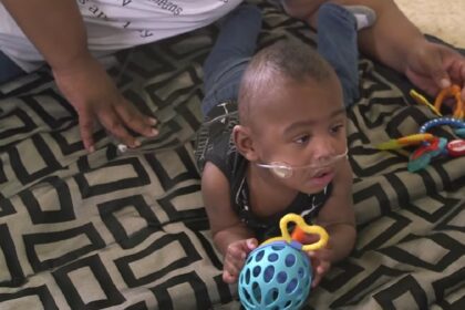 Meest premature baby ter wereld heeft zijn tweede verjaardag gevierd