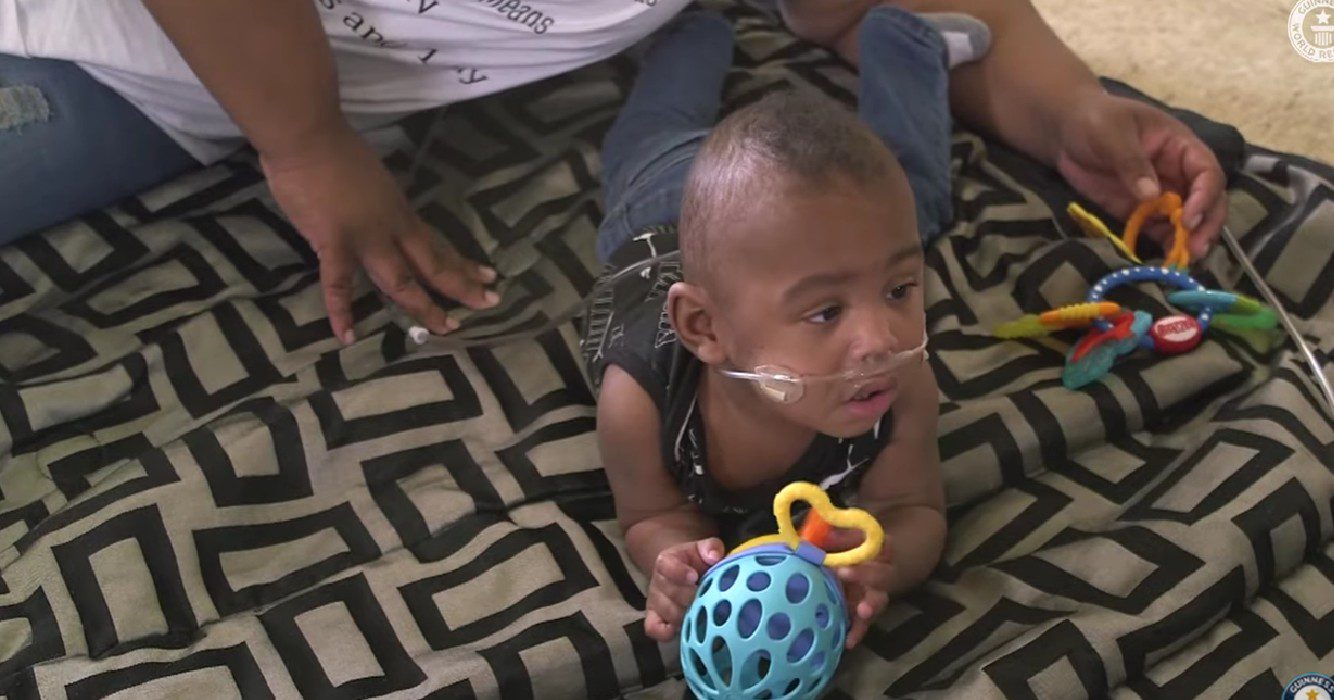 Meest premature baby ter wereld heeft zijn tweede verjaardag gevierd