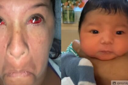 Moeder bevalt van zon grote baby dat ze aangeeft dat elk bloedvat in mijn gezicht barstte